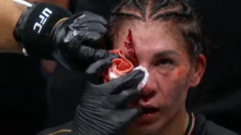Irene Aldana cae ante Norma Dumont en Noche UFC tras sufrir corte y dominio brasileño