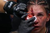 Irene Aldana cae ante Norma Dumont en Noche UFC tras sufrir corte y dominio brasileño