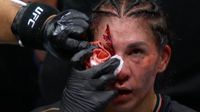 Irene Aldana cae ante Norma Dumont en Noche UFC tras sufrir corte y dominio brasileño
