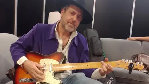 Alejandro Marcovich sufre lamentable accidente ¿Podrá seguir tocando?
