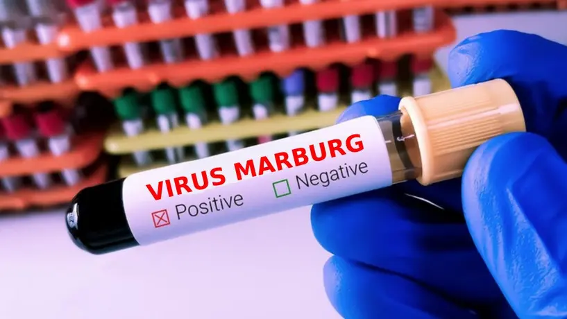 SSa lanza alerta por virus de Marburg; el nivel de riesgo es alto