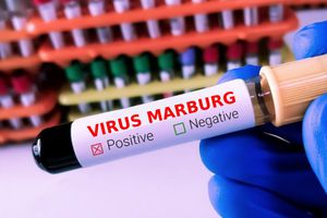 SSa lanza alerta por virus de Marburg; el nivel de riesgo es alto