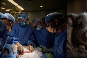 Trasplantan riñón de cerdo a humano ¡Ya van tres casos!