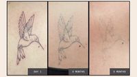 ¿Tatuajes efímeros? Duran poco más de un año y luego desaparecen