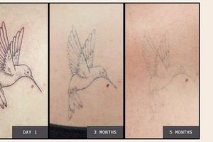 ¿Tatuajes efímeros? Duran poco más de un año y luego desaparecen