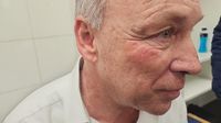 Hijo de Andrés Fassi comparte primeras imágenes del golpe recibido por árbitro argentino