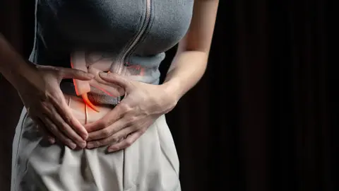 La apendicitis es la inflamación del apéndice y se considera una emergencia médica. / iStock