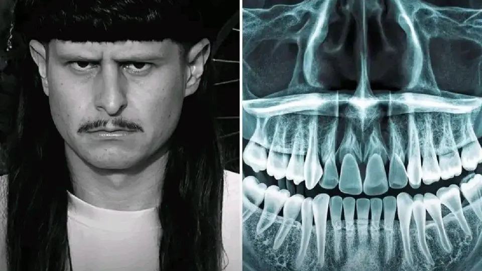 La identificación del cuerpo se logró a una radiografía de su dentadura / Redes Sociales