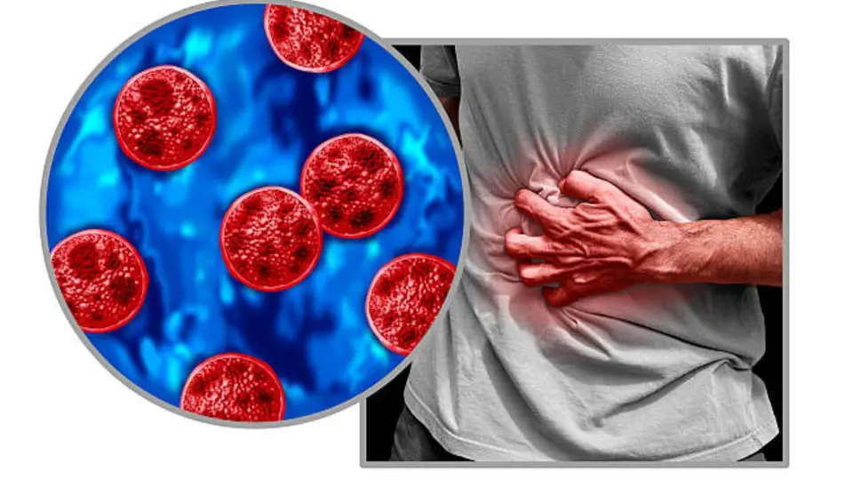 La ciclosporiasis es una infección intestinal causada por el parásito Cyclospora cayetanensis, que se transmite principalmente por alimentos y agua contaminados. / iStock