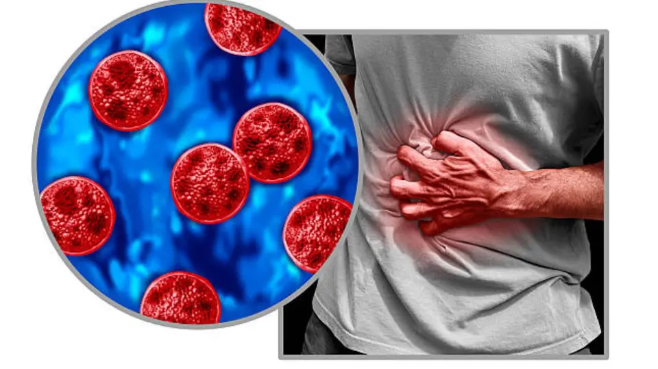 La ciclosporiasis es una infección intestinal causada por el parásito Cyclospora cayetanensis, que se transmite principalmente por alimentos y agua contaminados. / iStock