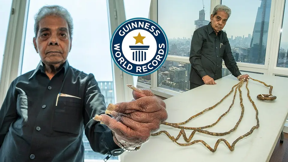 La uña del pulgar era la más larga de su mano izquierda y alcanzó los 197.8 centímetros./  Guinness World Records