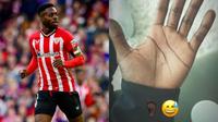 ¡De no creerse! Iñaki Williams jugó por dos años con un cristal enterrado en la planta del pie
