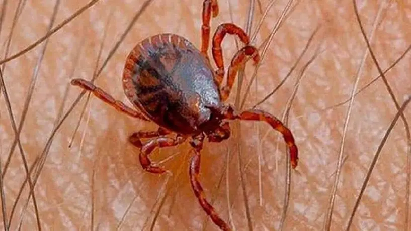 ¿Qué es la enfermedad rickettsia transmitida por garrapatas? Ya ha cobrado 2 vidas