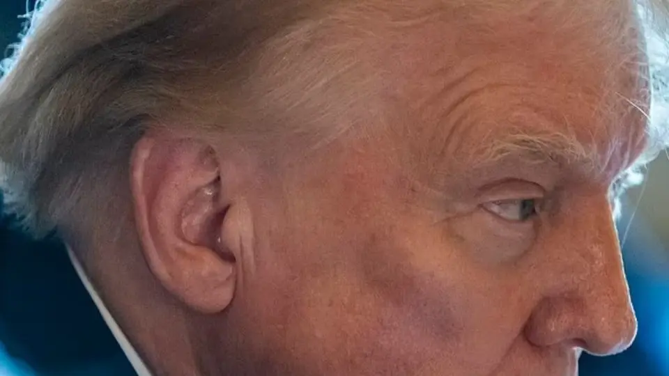 El médico de Trump da actualización sobre su recuperación del tiroteo mientras aparece sin vendaje