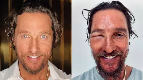 ¿Qué le pasó al actor Matthew Mcconaughey? Fans están preocupados