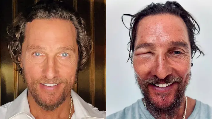 ¿Qué le pasó al actor Matthew Mcconaughey? Fans están preocupados