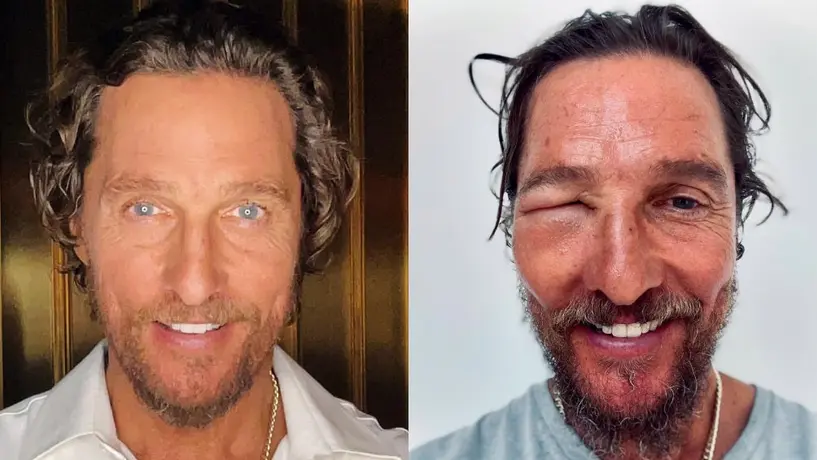 ¿Qué le pasó al actor Matthew Mcconaughey? Fans están preocupados