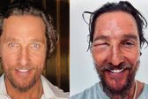 ¿Qué le pasó al actor Matthew Mcconaughey? Fans están preocupados