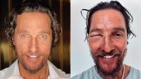 ¿Qué le pasó al actor Matthew Mcconaughey? Fans están preocupados