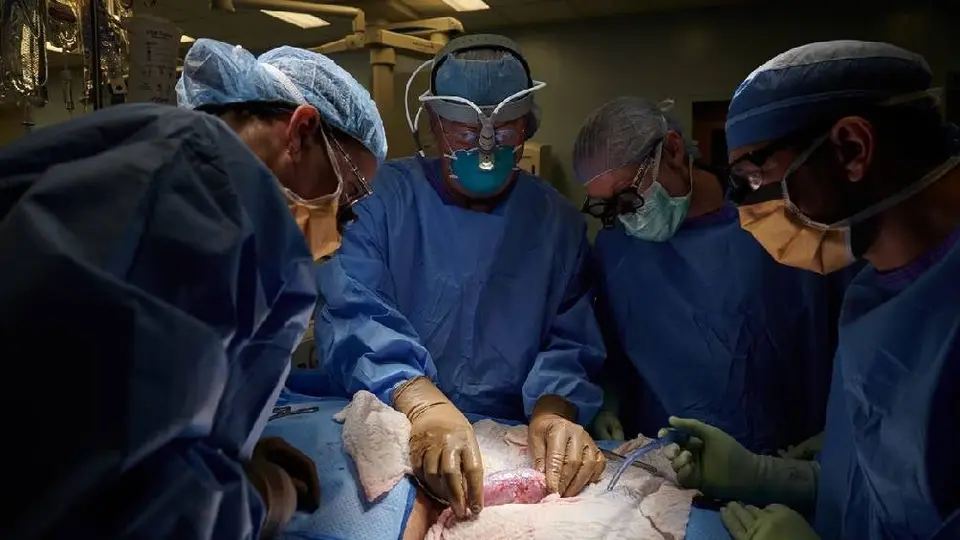 Muere paciente que recibió primer trasplante de riñón de cerdo modificado genéticamente