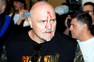 Padre de Tyson Fury sobre el cabezazo a miembro del equipo de Usyk: 'Era un tipo irrespetuoso'