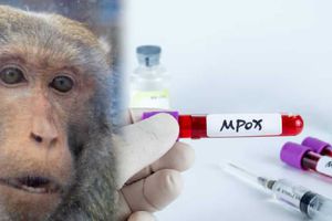 ¿Cuántos casos de viruela del mono hay en México?