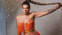 Kimberly, 'la más preciosa', fue operada de emergencia. Te contamos lo que sabemos