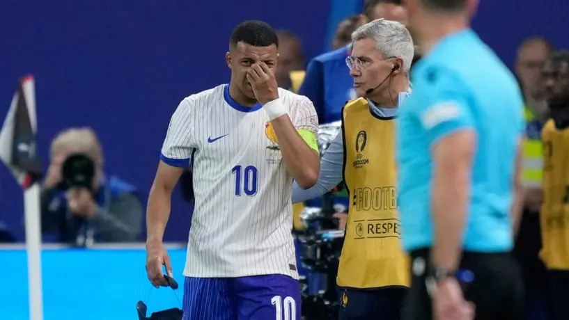 Euro 2024: Mbappé, noqueado y sustituido ante España tras golpe en la nariz