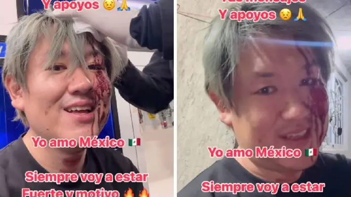 VIDEO: Japonés declara su amor por México, pese a sufrir asalto en Monterrey