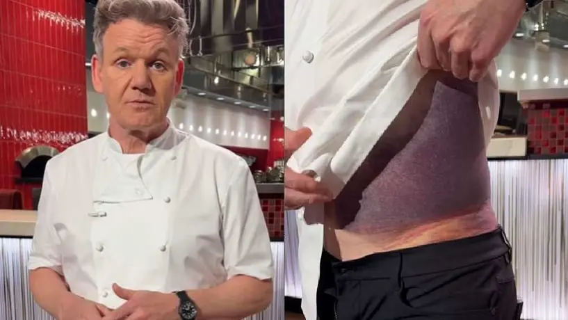 ¡Chef Gordon Ramsay casi se muere! Aquí te contamos los detalles