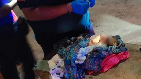 Bebé recién nacido es abandonado en contenedor de basura