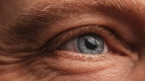 12 de marzo: Día Mundial del Glaucoma ¿Por qué se celebra?