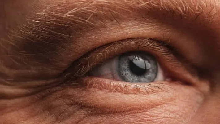 12 de marzo: Día Mundial del Glaucoma ¿Por qué se celebra?
