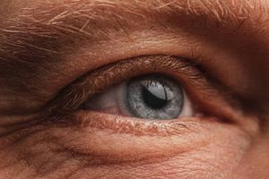 12 de marzo: Día Mundial del Glaucoma ¿Por qué se celebra?