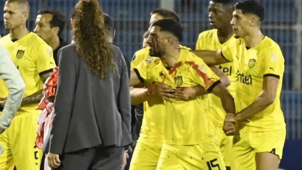 ¡Violencia en estadio! Maxi Olivera, jugador de Peñarol, golpeado por piedra lanzada desde la gradas