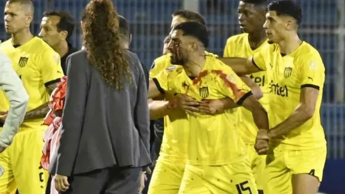 ¡Violencia en estadio! Maxi Olivera, jugador de Peñarol, golpeado por piedra lanzada desde la gradas