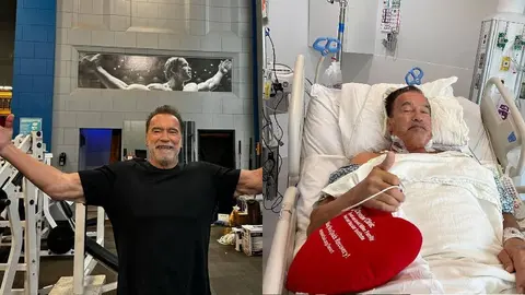 Arnold Schwarzenegger revela que le colocaron un marcapasos