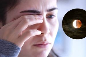 ¿Cuáles son los sintomas en la vista después de ver un Eclipse Solar?