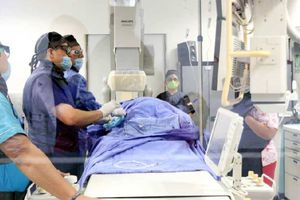 4 muertos por el síndrome de Guillain-Barré; hay 34 casos confirmados en Tlaxcala