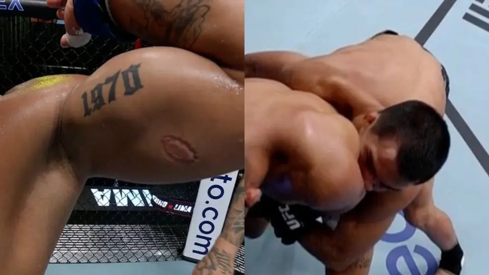 UFC Vegas 89: Igor Severino es descalificado por morder a su rival a la mitad del combate