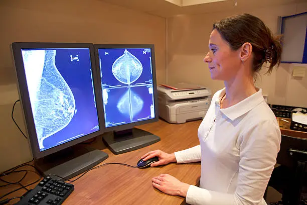 Las mujeres de 40 a 69 años son la población prioritaria de la jornada gratuita de detección de cáncer de mama en Ciudad Universitaria./ Pixabay