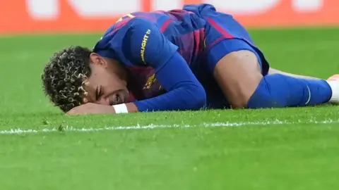 Lamine Yamal enciende alarmas en Barcelona al no entrenar previo al juego ante Espanyol