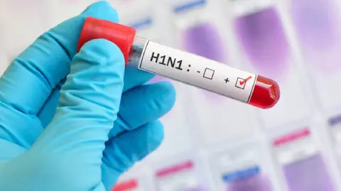 ¿Cuáles son los síntomas? Influenza deja 7 muertes y más de 2 mil casos en México