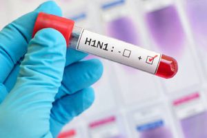 ¿Cuáles son los síntomas? Influenza deja 7 muertes y más de 2 mil casos en México