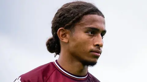 Tahirys Dos Santos, jugador del Metz, hospitalizado de emergencia tras incendio en Suiza
