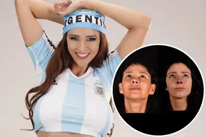 Dorismar reaparece con su nueva nariz tras cirugía reconstructiva: así avanza su recuperación