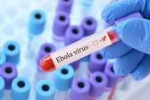 Confirman primer caso de ébola sin vacuna en Estados Unidos