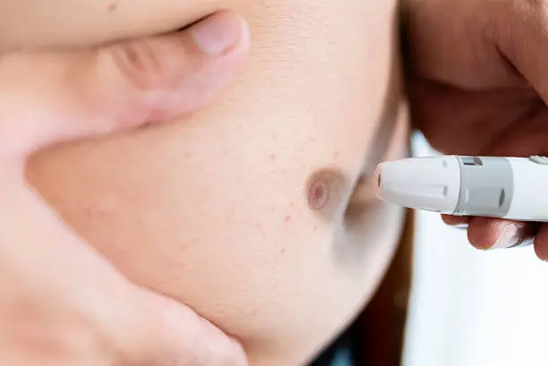 El nuevo tratamiento actúa bloqueando la proteína PCSK9, el mismo mecanismo que utilizan algunos medicamentos inyectables para controlar el colesterol./ Pixabay
