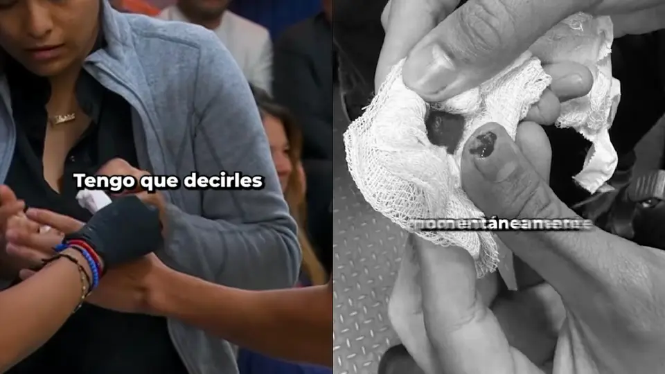 El concursante tuvo que ser atendido por paramédicos y llevado a un hospital / Especial