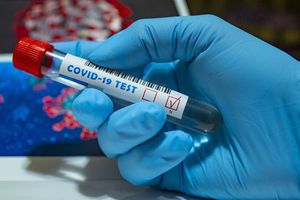 El Covid-19 sigue siendo una amenaza en el mundo: OMS